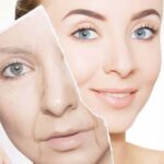 Best Anti-Aging Treatment in Surat