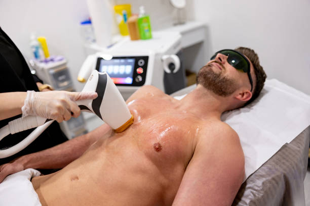 Laser Hair Removal for Chest