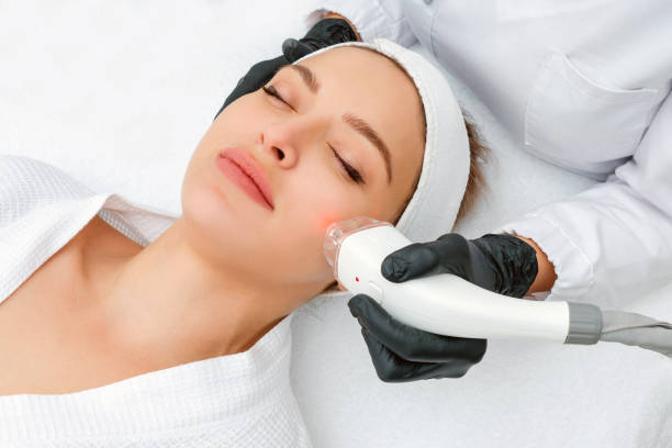 Laser Hair Removal for Face in Surat