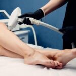 Laser hair removal for legs in Surat