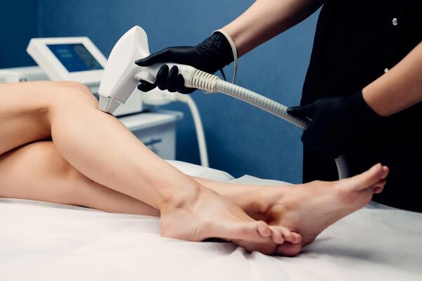 Laser hair removal for legs in Surat