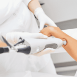 Full-body laser hair removal Surat