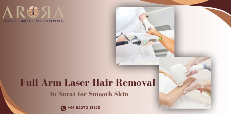 Full Arm Laser Hair Removal in Surat for Smooth Skin